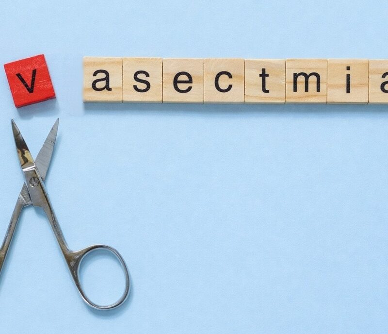 vasectomia