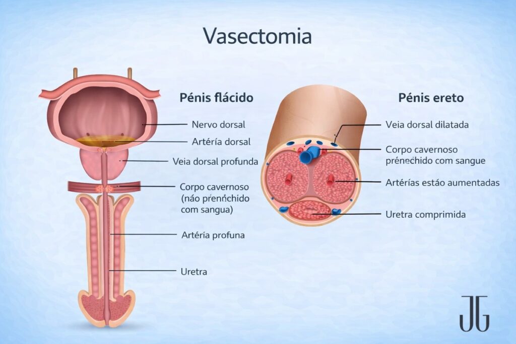 como é feita a vasectomia
