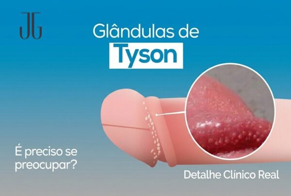 glândulas de tyson