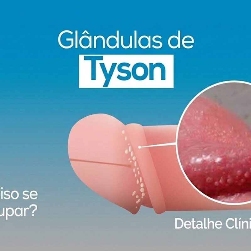 glândulas de tyson